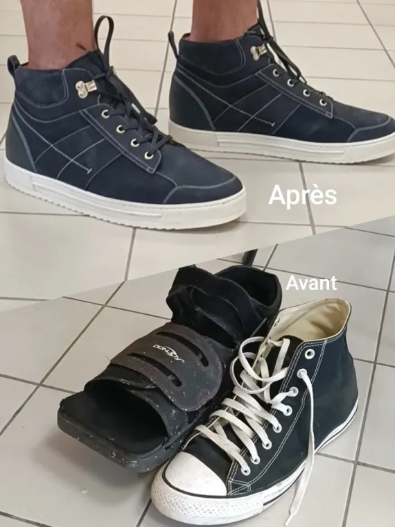 Le diabete et les chaussures orthopédiques, Lille, Podo Adapt